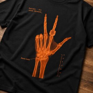 jalen brunson hand x ray shirt1